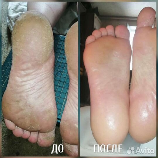 Мастер педикюра