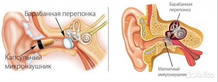 Микрокамера