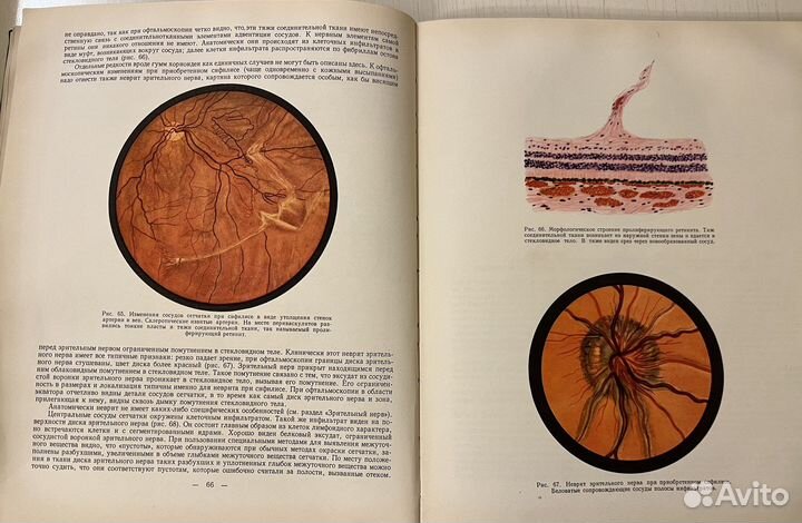 Основы офтальмоскопической диагностики