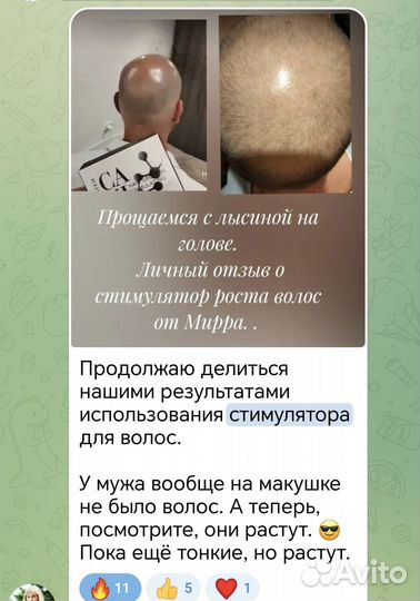 От выпадения волос