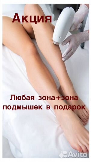 Лазерная эпиляция