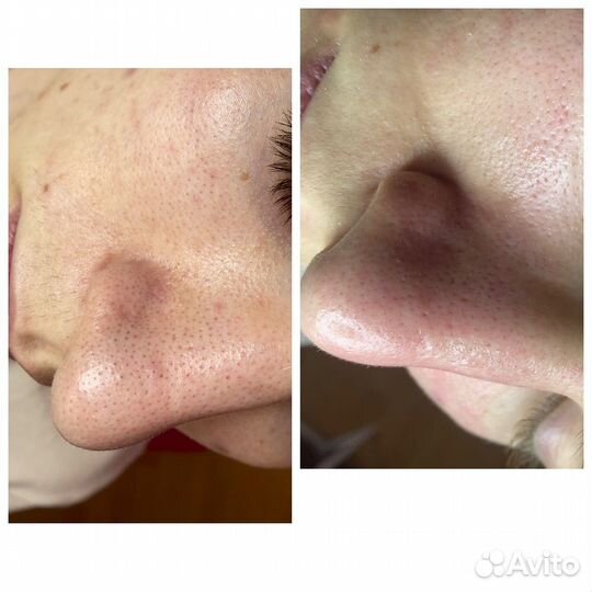 Нужны модели