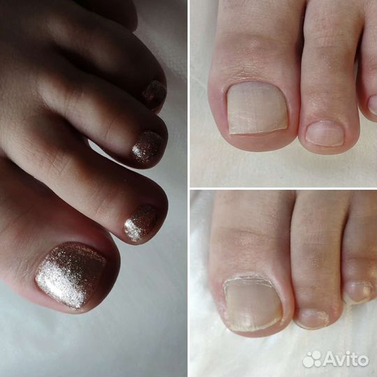 Маникюр и покрытие гель-лак, педикюр, наращивание