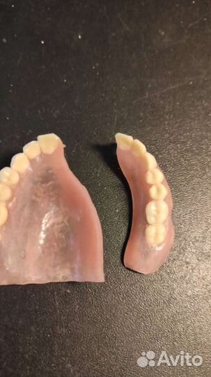 Ремонт зубных протезов