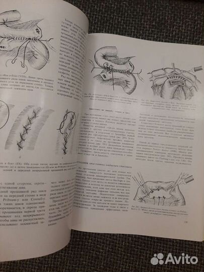 Брюшная Хирургия. Имре Литтманн