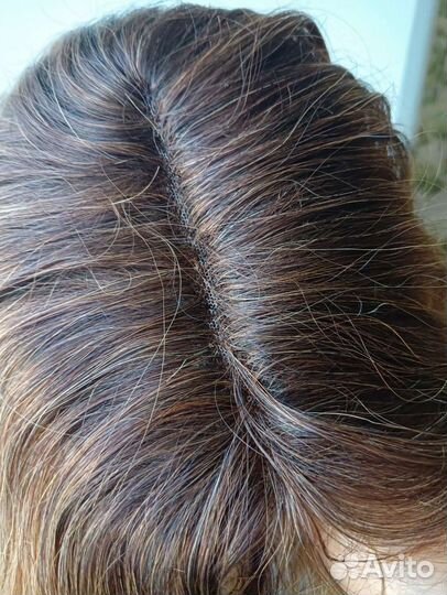 Натуральная система замещения волос