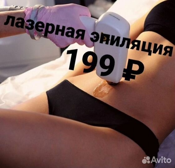 Лазерная эпиляция