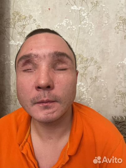 Рандомная работа инвалид первой группы по зрению