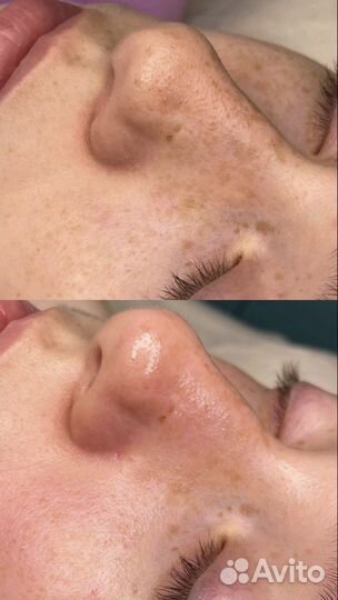 Услуги косметолога