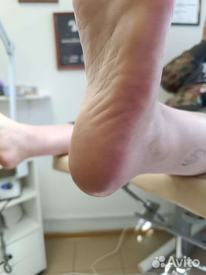 Педикюр,маникюр,подолог,выезд на дом