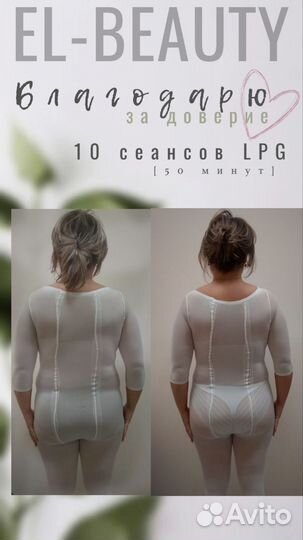 LPG массаж