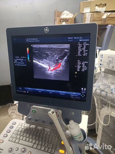 Аренда узи аппарата