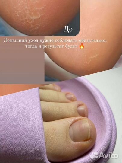 Педикюр/ подолог