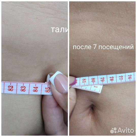 Антицеллюлитный ручной массаж
