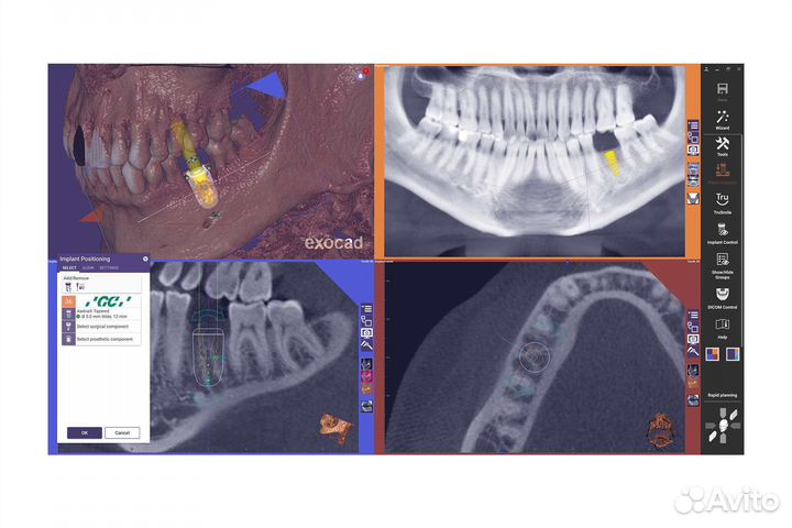 Exoplan Rijeka 3.1 v8587 (2023-07-06 )