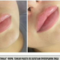 Косметолог с мед образованием увеличение губ, Красногорск