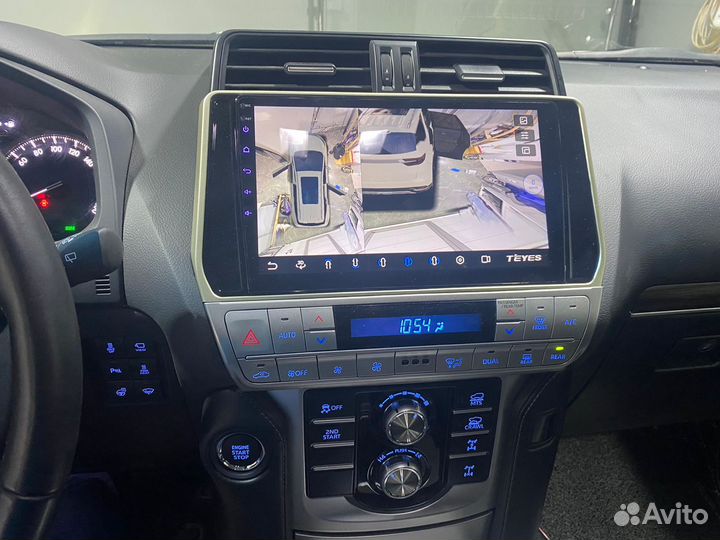 Система кругового обзора 360