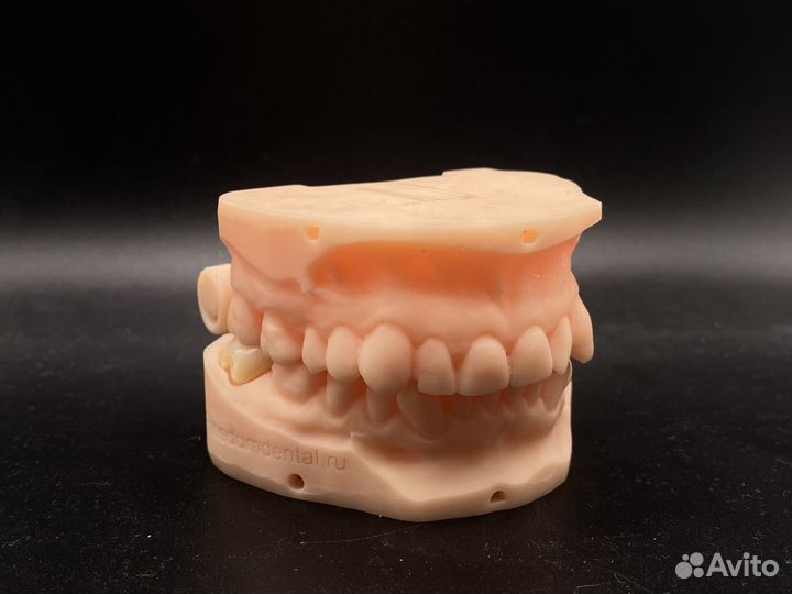 Коронка циркониевая/ e-max наготово по интраоральн