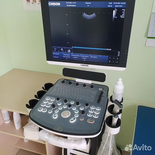Узи аппарат Chison