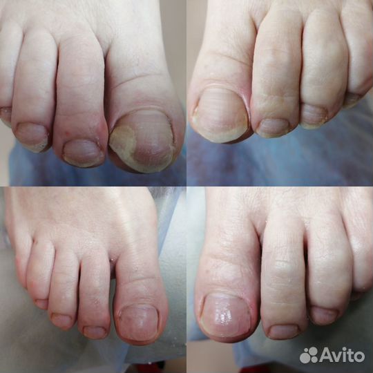 Услуги подолога