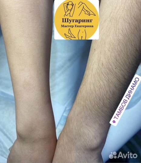 Шугаринг мужской/ женский