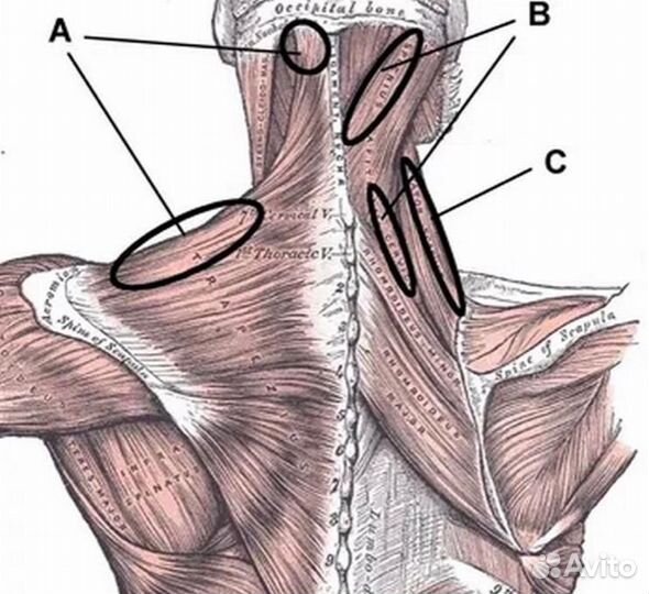 Массаж/мануальный, костоправ избавление от боли