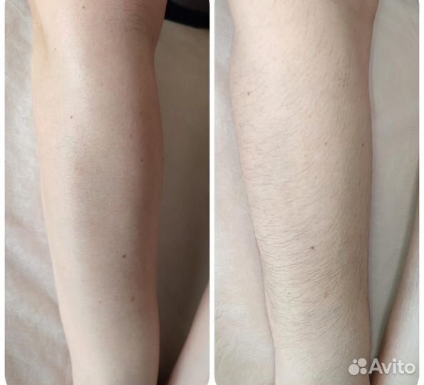 Депиляция воском / Гелинг