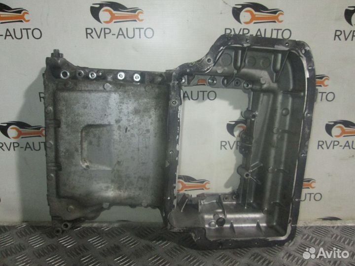 Поддон масляный двигателя Mercedes Benz OM651 2.2d