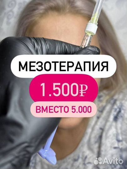 Мезотерапия лица