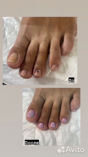 Педикюр