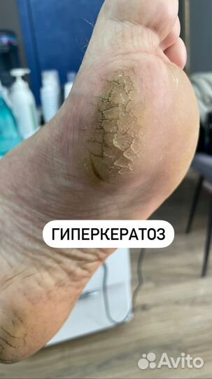 Курсы подологии