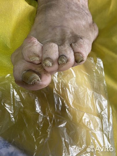 Подологический педикюр и маникюр