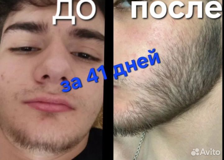 Лосьон для роста волос