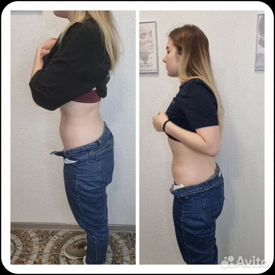 Антицеллюлитный массаж ручной