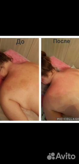 Массаж на дому