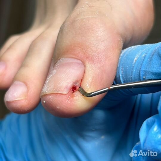 Подолог, маникюр, педикюр