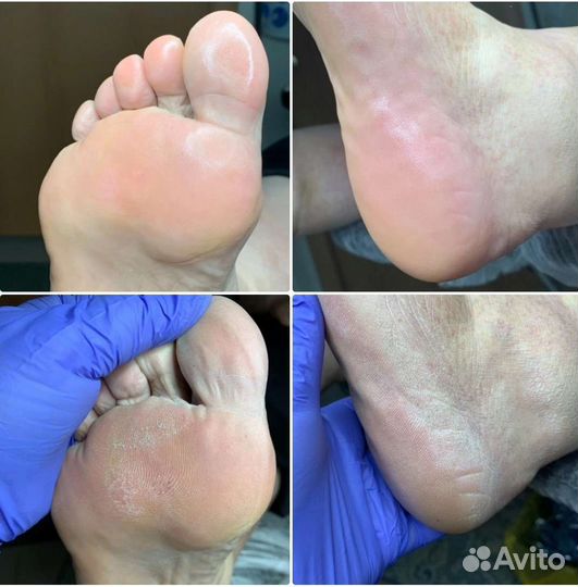 Маникюр/педикюр