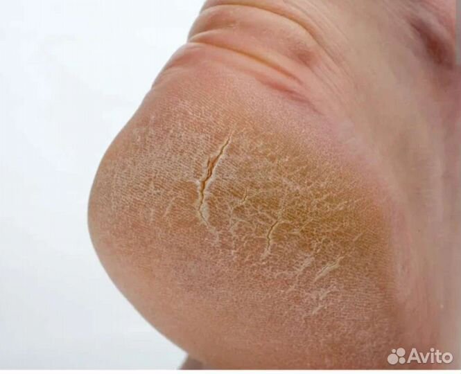 Маникюр и педикюр