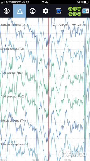 Нейрогарнитура NeuroPlay 6C