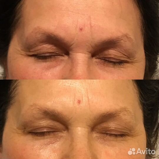 Комплекс самомассажа лица