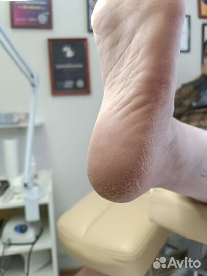 Педикюр,маникюр,подолог,выезд на дом