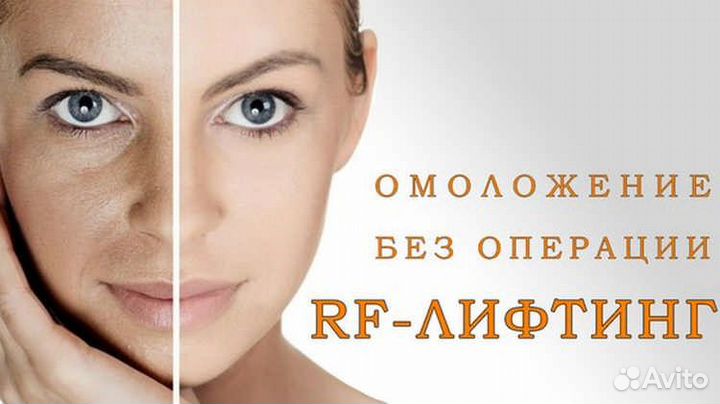 Микроигольчатый RF лифтинг/ Омоложение