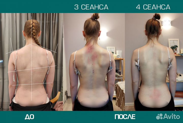 Костоправ. Массаж. Вправление