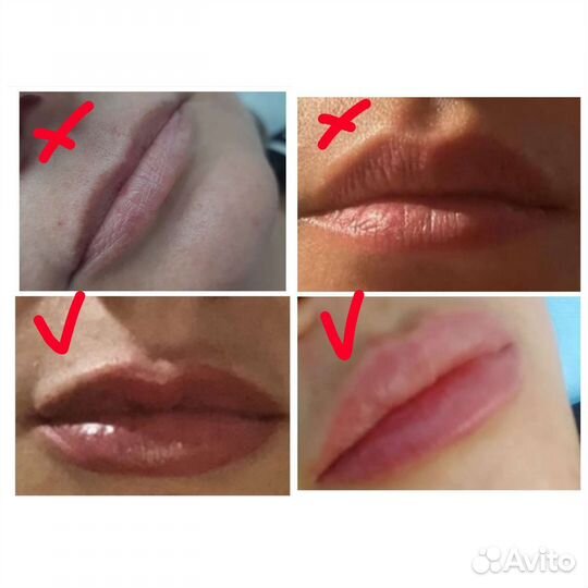 Массажистка, врач косметолог