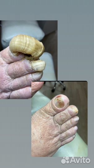 Подолог с выезжом на дом