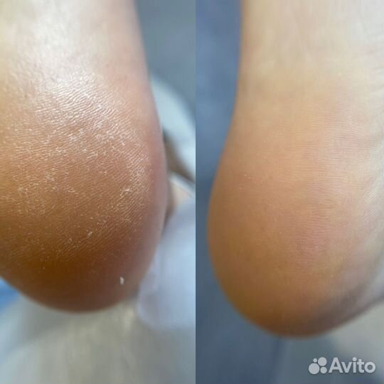 Модели на педикюр