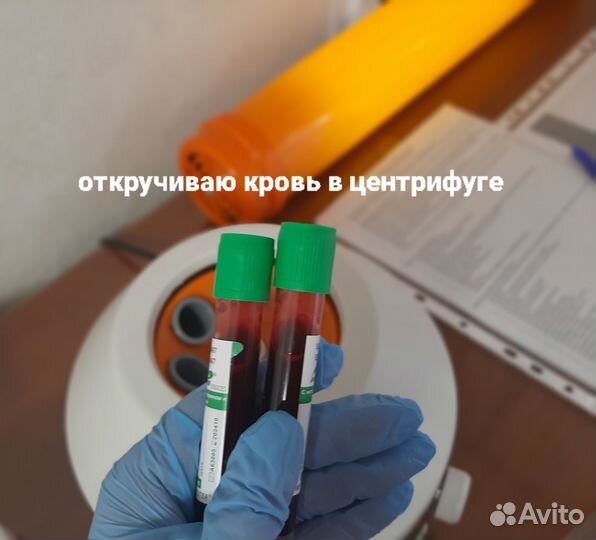Контурная пластика, увеличение губ, плазма