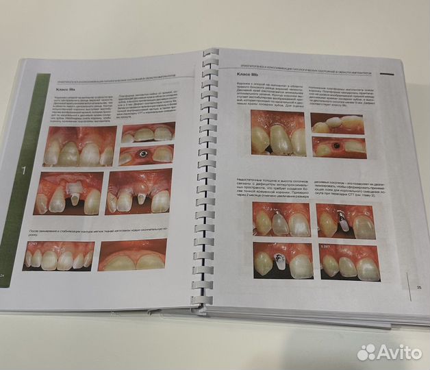 Пластическая хирургия мягких тканей Зукелли 2023