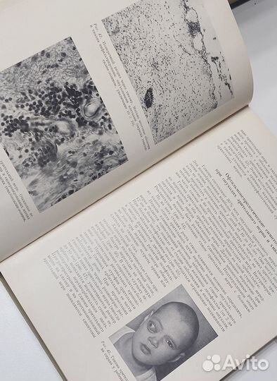 Основы нейрохирургии детского возраста 1968 г