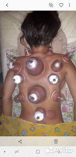 Банки для хиджамы 10 см